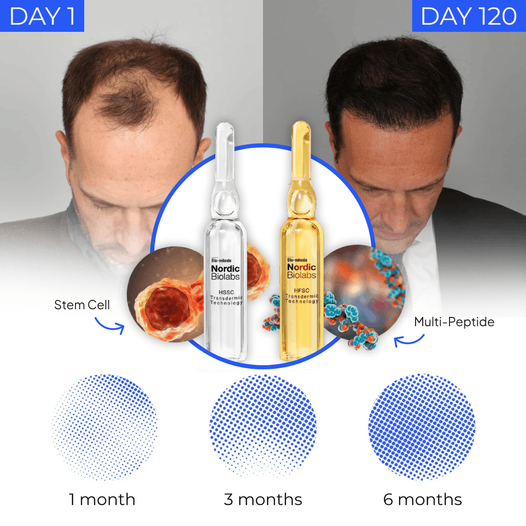 STEM Cell Complete Hair Cycle Solution 2.0 – Nordic Biolabs