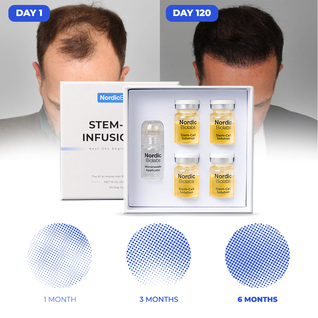 Stem Cell Infusion Kit – Nordic Biolabs