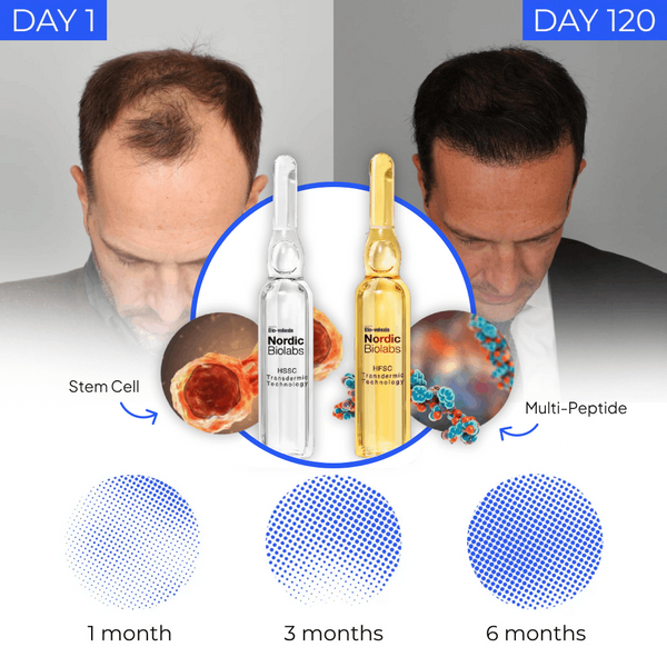 ampulestemcellpp_1024x1024_6_g