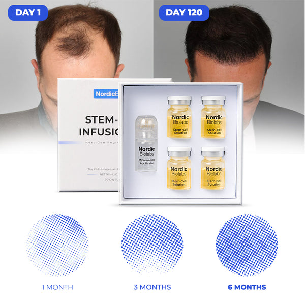 VUIVUI BYEOLEE STEMCELL ALL IN ONE 2本セット Stem Cell Infusion Kit – Nordic Biolabs