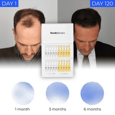 Complete Hair Cycle Solution